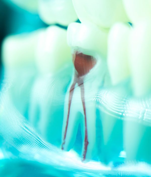 man smiling in dentists chair